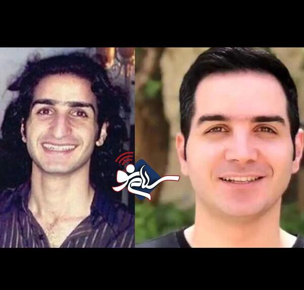 عکس احسان علیخانی قبل و بعد از عمل زیبایی