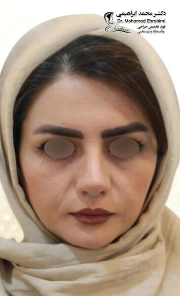 عکس محمد زیبایی