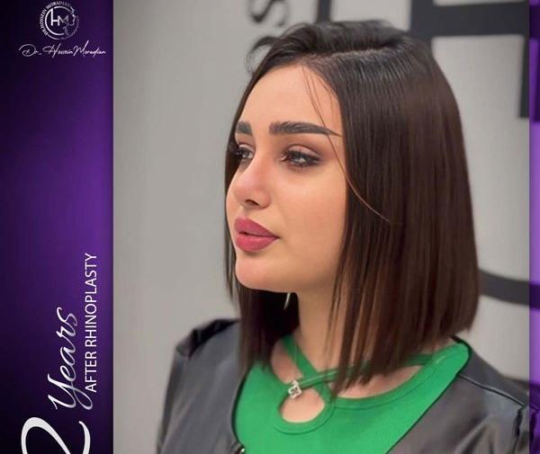 عکس عمل بینی دکتر حسین مرادیان