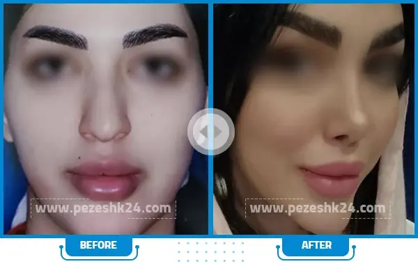 عکس عمل بینی دکتر حسین مرادیان