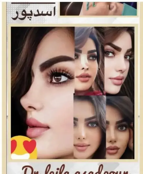 عکس عمل بینی دکتر حسین مرادیان