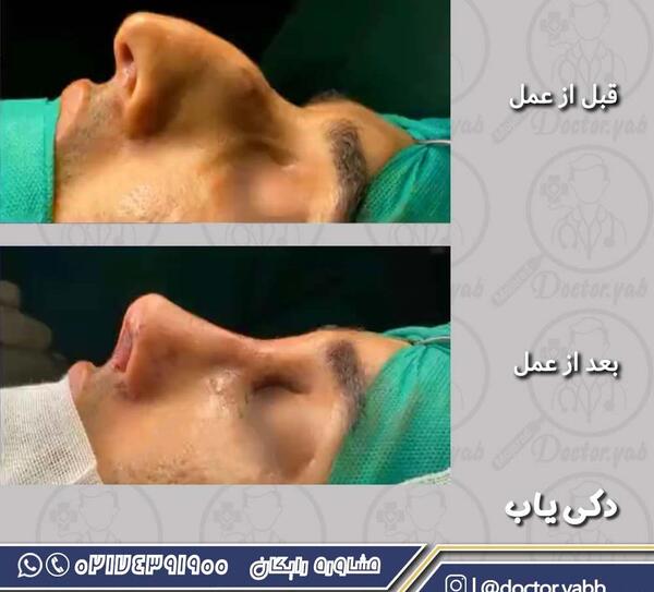 عکس عمل بینی دکتر حسین مرادیان