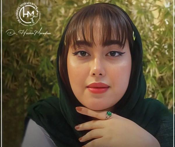 عکس عمل بینی دکتر حسین مرادیان