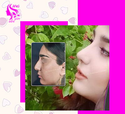 عکس عمل بینی دکتر حسین مرادیان