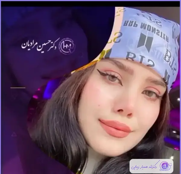 عکس عمل بینی دکتر حسین مرادیان