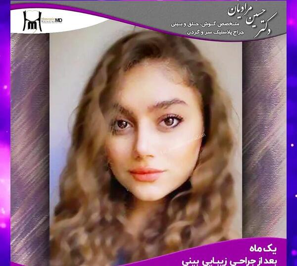 عکس عمل بینی دکتر حسین مرادیان
