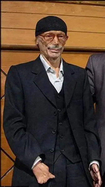 عکس حسن امیدزاده قبل از سوختگی
