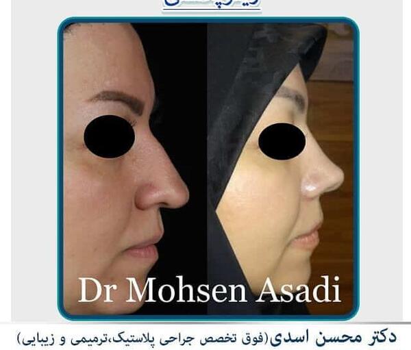 عکس محسن یگانه قبل از عمل جراحی