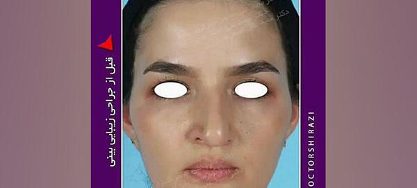 گالری عکس دکتر محسن نوری شیرازی