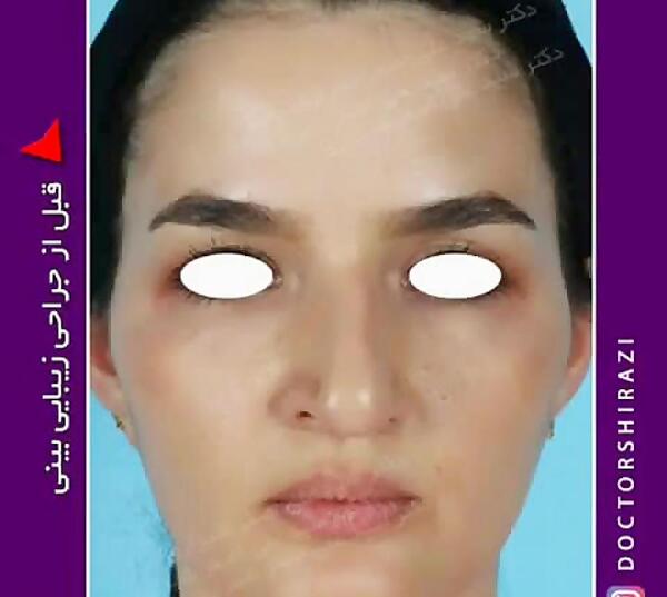 گالری عکس دکتر محسن نوری شیرازی