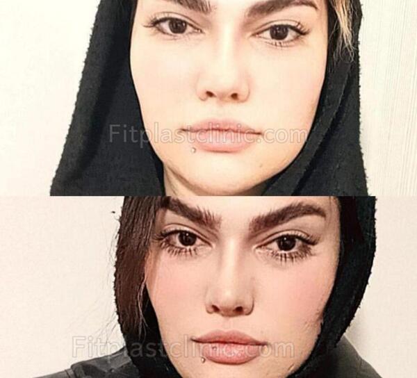 عکس محسن یگانه قبل عمل دماغ