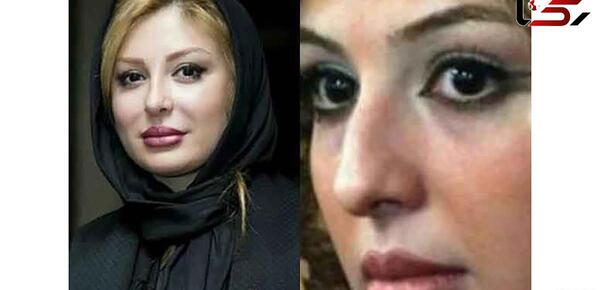 عکس محسن یگانه قبل عمل دماغ