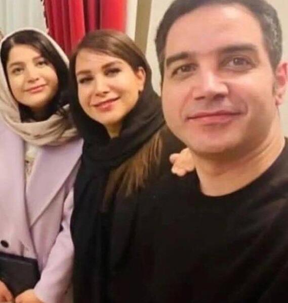 عکس محسن یگانه قبل عمل دماغ