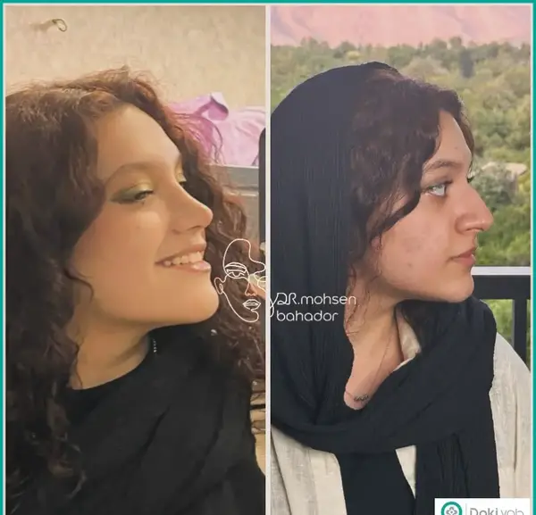 عکس محسن یگانه قبل عمل دماغ