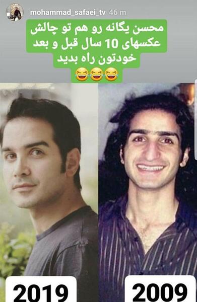 عکس محسن یگانه قبل عمل دماغ