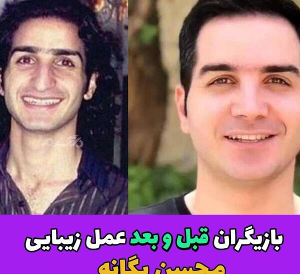 عکس محسن یگانه قبل عمل دماغ