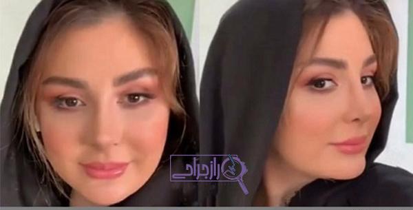 عکس محسن یگانه قبل عمل بینی