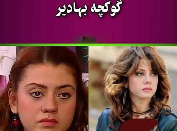 عکس محسن یگانه قبل عمل بینی