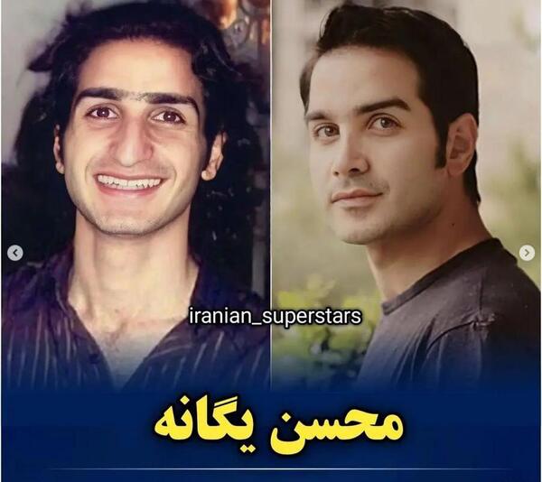 عکس محسن یگانه قبل عمل بینی