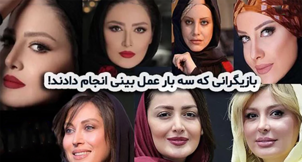عکس محسن یگانه قبل عمل بینی