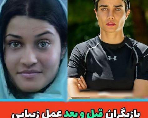 عکس محسن یگانه قبل عمل بینی