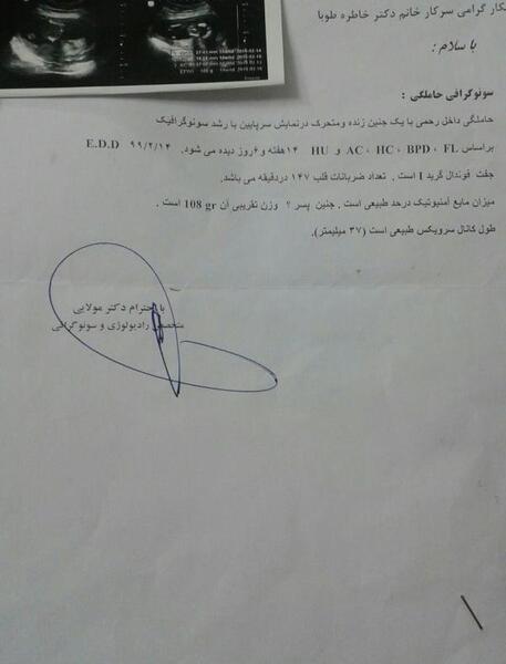 عکس سونوی ان تی پسر نی نی سایت