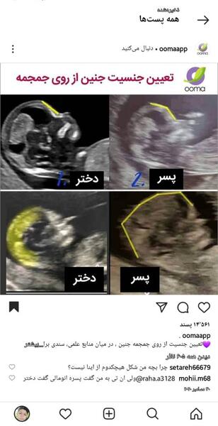 عکس سونوی ان تی پسر نی نی سایت