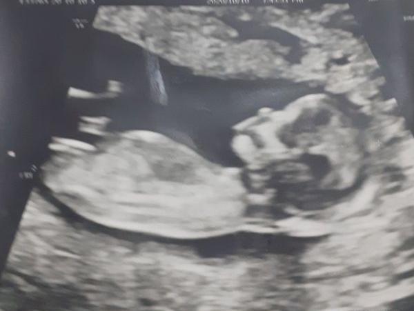 عکس سونوی ان تی پسر نی نی سایت