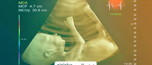 عکس فیک اکو قلب