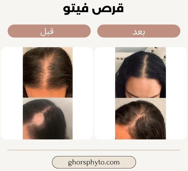 عکس فیک قرص فیتو