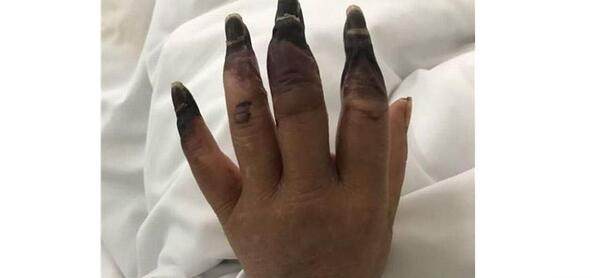 عکس فیک صورت زخمی