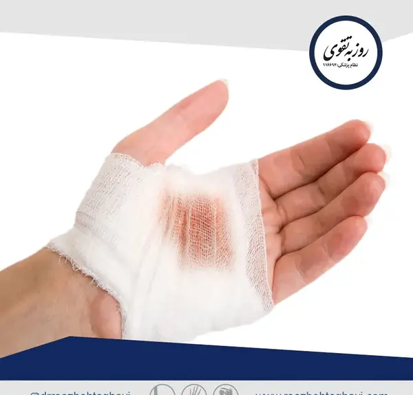 عکس فیک رگ دست دختر