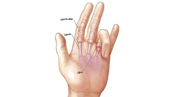 عکس فیک رگ دست دختر