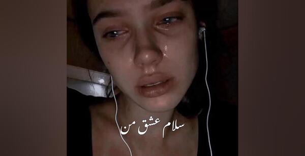 عکس فیک رگ دست دختر