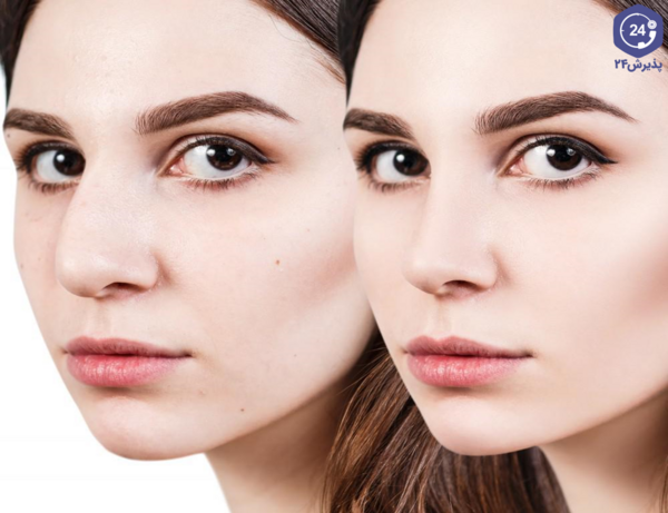 عکس فیک خون دماغ دخترانه