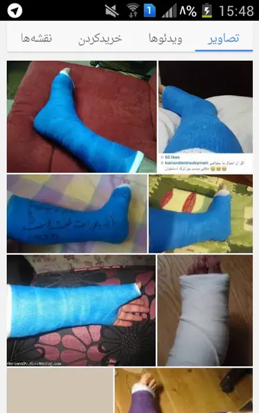 عکس فیک گچ پا