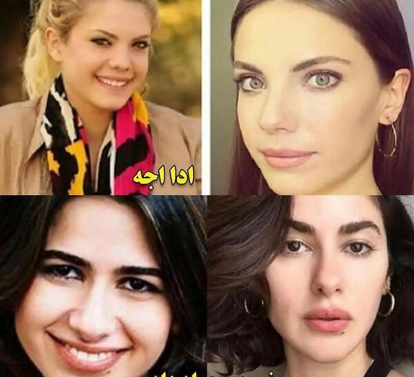 عکس های قبل از عمل اوزگه یاگیز