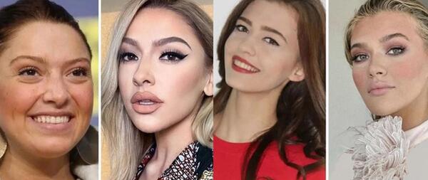 عکس آسلیهان گونر قبل از عمل