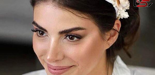 عکس قبل از عمل دنیز بایسال