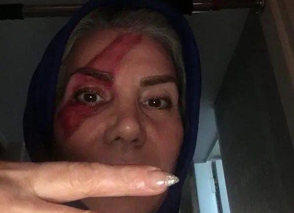 سحر عکس خانه تتلو در ترکیه