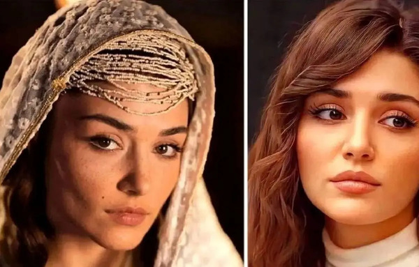 عکس چاقی و لاغری هانده ارچل