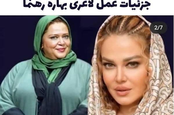 عکس چاقی و لاغری هانده ارچل