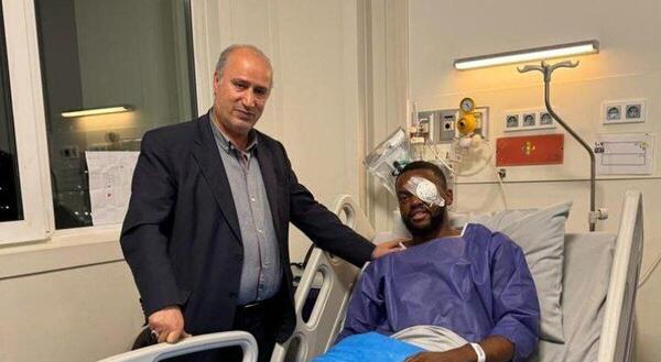 عکس چشم آسیب دیده یامگا