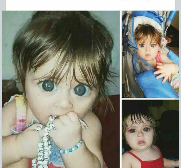 عکس آدم چشم گنده