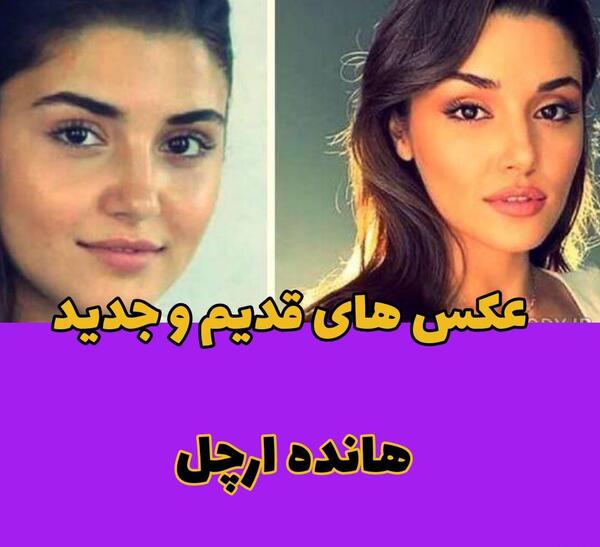 عکس بازیگران ترکیه هانده ارچل