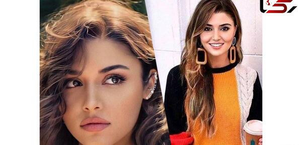 عکس های قبل و بعد از عمل هانده ارچل