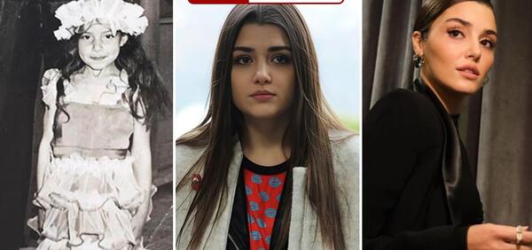 عکس قبل و بعد از عمل زیبایی هانده ارچل
