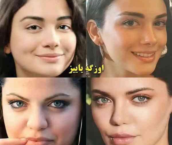 عکس واقعی هانده ارچل قبل از عمل زیبایی