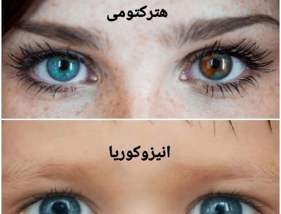 عکس آدم های چشم رنگی