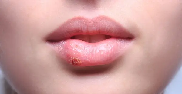 عکس چشم زن باردار پسر نی نی سایت